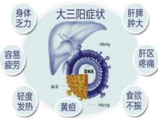 乙肝大三阳有哪些症状