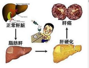 脂肪肝对身体会造成什么的危害